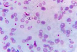 Plasmodium_falciparum_gametocyte