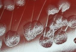 Pseudomonas_aeruginosa_colony_morphology_on_blood_agar