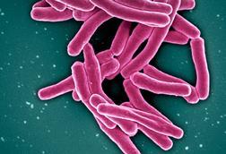 Mycobacterium_Tuberculosis_Bacteria,_the_Cause_of_TB_(52766234986)