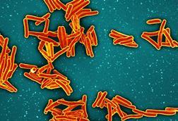 Mycobacterium_Tuberculosis_Bacteria_-_53604014169