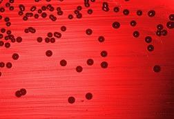 Haemophilus_influenzae_01