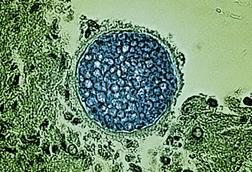 Coccidioides_Fungal_Spherule_-_12