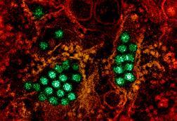 Dengue_Virus_Particles_(53231045112)