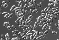 Microscopic_image_of_yeasts.tif