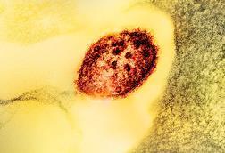 Measles_Virus_Particle