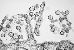 Sin_Nombre_hanta_virus_TEM_PHIL_1136_lores