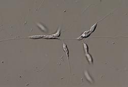 Protist_labyrinthula_1000_Maple_Ferryman