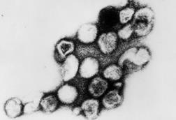 Rubella_virus_TEM_B82-0203_lores