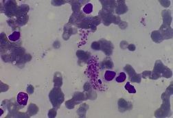 Amastigotes_of_Leishmania_donovani
