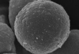 Sutterella_megalosphaeroides