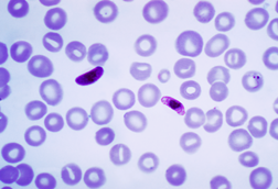 Plasmodium_falciparum_01