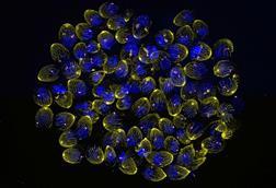 Low-Res_20250308_UExM_tgDS083_72h_IAA_SetB_Tub-Cen_002 - Deconvolved, Type Automatic-MaxIP_GOOD