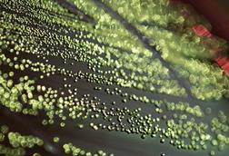 Escherichia_coli_EMB