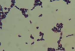 Enterococcus_faecium_in_Gram_Staining_of_culture