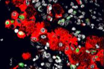 Low-Res_macrophages-sm