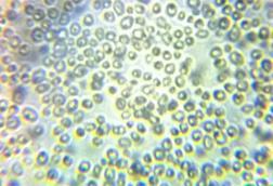 Microscope_view_of_Candida_albicans_34