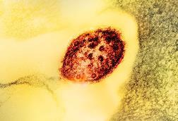 Measles_Virus_Particle (1)