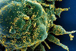 SARS-COV-2_virus (1)