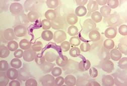 T._cruzi_trypomastigotes_in_peripheral_blood_smear