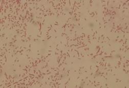 Gram_Negative_Rods_of_Aeromonas_hydrophila