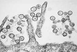 Sin_Nombre_hanta_virus
