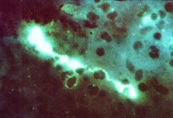 Chlamydophila_psittaci_FA_stain