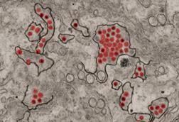 Zika_Virus_Particles