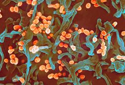 Lassa_virus_budding_off_a_Vero_cell