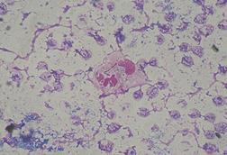 Pseudomonas_aeruginosa_smear_Gram_2010-02-10