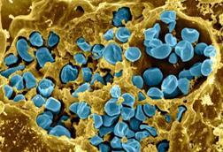 Macrophage_Infected_with_Francisella_tularensis_Bacteria_(5950310835)