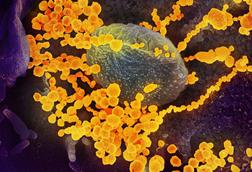 SARS-CoV-2_scanning_electron_microscope_image (1)