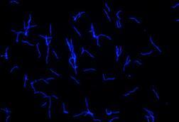 Low-Res_Borrelia_recurrentis_c_Flavia_Reyer_unimedizin-ffm