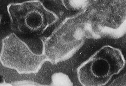 Epstein_Barr_Virus_virions_EM_10.1371_journal.pbio.0030430.g001-L