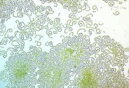Low-Res_Wild filamentous cyanobacteria that are similar to laboratory cultures of Nostoc punctiforme