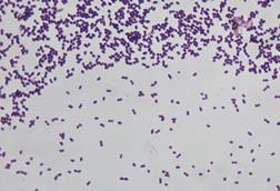 Enterococcus_faecalis