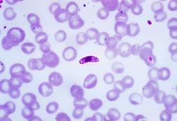 Macrogametocyte_of_the_parasite_Plasmodium_falciparum_PHIL_2701_lores