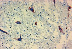 CSIRO_ScienceImage_349_Avian_influenza_in_the_brain_of_a_chicken_embryo