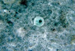 Entamoeba_histolytica_01