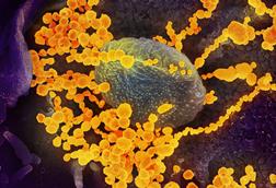 SARS-CoV-2_scanning_electron_microscope_image