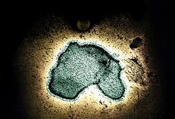 Human_Respiratory_Syncytial_Virus_(RSV)_-_11111