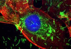 Low-Res_F. nucleatum inside breast epithelial cells