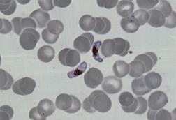 P.falciparum-gametocytes