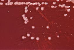 Pseudomonas_aeruginosa_01