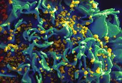 HIV-infected_H9_T_cell_(6813403685)
