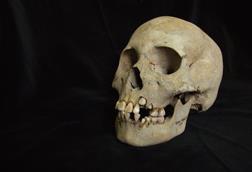 The skull of a 9-11 year old girl