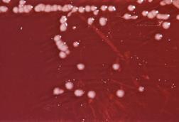 Pseudomonas_aeruginosa_01