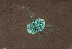 Macrophage_(17195150690)
