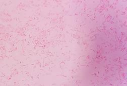 Capnocytophaga_canimorsus_gram_stain