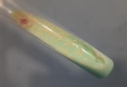 Mycobacterium_tuberculosis_growth_on_L-J_medium (1)