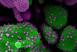 Novel_Coronavirus_SARS-Cov-2_(50011008502)